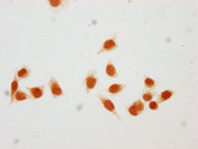 Immunocytochemistry analysis of CSB-PA010378OA116hibHU diluted at 1:50 and staining in Hela cells (treated with 30mM sodium butyrate for 4h) performed on a Leica BondTM system. The cells were fixed in 4% formaldehyde, permeabilized using 0.2% Trit...