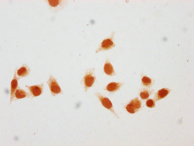 Immunocytochemistry analysis of CSB-PA010378OA116hibHU diluted at 1:50 and staining in Hela cells (treated with 30mM sodium butyrate for 4h) performed on a Leica BondTM system. The cells were fixed in 4% formaldehyde, permeabilized using 0.2% Trit...