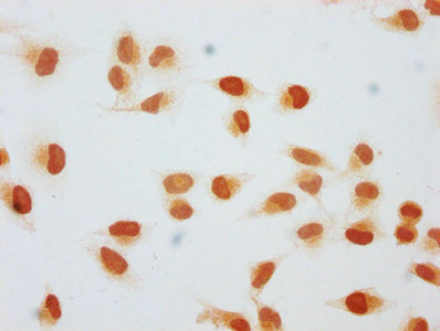 Immunocytochemistry analysis of CSB-PA010378OA128hibHU diluted at 1:50 and staining in Hela cells (treated with 30mM sodium butyrate for 4h) performed on a Leica BondTM system. The cells were fixed in 4% formaldehyde, permeabilized using 0.2% Trit...