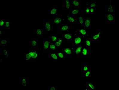 Immunofluorescence staining of Hela cells (treated with 30mM sodium butyrate for 4h) with CSB-PA010378OA135hibHU at 1:25, counter-stained with DAPI. The cells were fixed in 4% formaldehyde, permeabilized using 0.2% Triton X-100 and blocked in 10%...