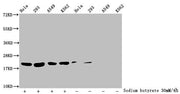 Western Blot Detected samples: Hela whole cell lysate, 293 whole cell lysate, A549 whole cell lysate, K562 whole cell lysate; Untreated (-) or treated (+) with 30mM sodium butyrate for 4h All lanes: HIST1H1C antibody at 1:100 Secondary Goat polycl...