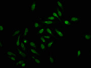 Immunofluorescence staining of Hela cells with CSB-PA010378OA159forHU at 1:2.5, counter-stained with DAPI. The cells were fixed in 4% formaldehyde, permeabilized using 0.2% Triton X-100 and blocked in 10% normal Goat Serum. The cells were then inc...