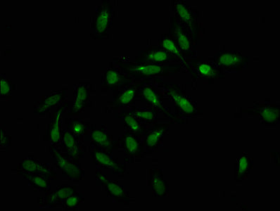 Immunofluorescence staining of Hela cells with CSB-PA010378OA159forHU at 1:2.5, counter-stained with DAPI. The cells were fixed in 4% formaldehyde, permeabilized using 0.2% Triton X-100 and blocked in 10% normal Goat Serum. The cells were then inc...