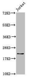 Western Blot Positive WB detected in: Jurkat whole cell lysate All lanes: HIST1H1C antibody at 1.7µg/ml Secondary Goat polyclonal to rabbit IgG at 1/50000 dilution Predicted band size: 22 kDa Observed band size: 22 kDa