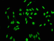 Immunofluorescence staining of Hela cells with CSB-PA010378OA164phHU at 1:5, counter-stained with DAPI. The cells were fixed in 4% formaldehyde, permeabilized using 0.2% Triton X-100 and blocked in 10% normal Goat Serum. The cells were then incuba...