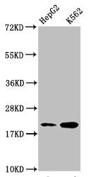 Western Blot Positive WB detected in: HepG2 whole cell lysate, K562 whole cell lysate All lanes: HIST1H1C antibody at 1:500 Secondary Goat polyclonal to rabbit IgG at 1/40000 dilution Predicted band size: 22 kDa Observed band size: 22 kDa