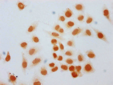 Immunocytochemistry analysis of CSB-PA010378OA168hibHU diluted at 1:40 and staining in Hela cells (treated with 30mM sodium butyrate for 4h) performed on a Leica BondTM system. The cells were fixed in 4% formaldehyde, permeabilized using 0.2% Trit...