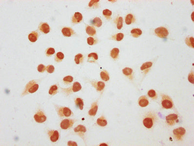 Immunocytochemistry analysis of CSB-PA010378OA210hibHU diluted at 1:40 and staining in Hela cells (treated with 30mM sodium butyrate for 4h) performed on a Leica BondTM system. The cells were fixed in 4% formaldehyde, permeabilized using 0.2% Trit...