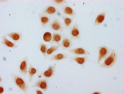 Immunocytochemistry analysis of CSB-PA010378OA22hibHU diluted at 1:5 and staining in Hela cells (treated with 30mM sodium butyrate for 4h) performed on a Leica BondTM system. The cells were fixed in 4% formaldehyde, permeabilized using 0.2% Triton...