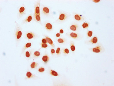 Immunocytochemistry analysis of CSB-PA010378OA25hibHU diluted at 1:10 and staining in Hela cells (treated with 30mM sodium butyrate for 4h) performed on a Leica BondTM system. The cells were fixed in 4% formaldehyde, permeabilized using 0.2% Trito...