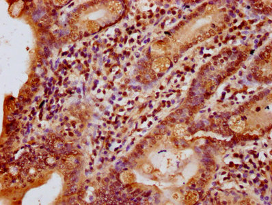 IHC image of CSB-PA010378OA25nhibHU diluted at 1:10 and staining in paraffin-embedded human small intestine tissue performed on a Leica BondTM system. After dewaxing and hydration, antigen retrieval was mediated by high pressure in a citrate buffe...