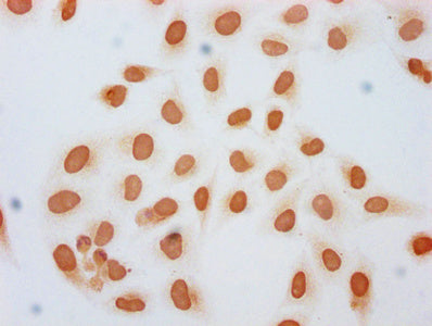 Immunocytochemistry analysis of CSB-PA010378OA45forHU diluted at 1:10 and staining in Hela cells (treated with 30mM sodium butyrate for 4h) performed on a Leica BondTM system. The cells were fixed in 4% formaldehyde, permeabilized using 0.2% Trito...