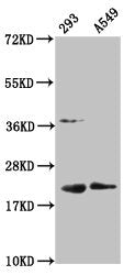 Western Blot Positive WB detected in: 293 whole cell lysate, A549 whole cell lysate All lanes: HIST1H1C antibody at 1:100 Secondary Goat polyclonal to rabbit IgG at 1/50000 dilution Predicted band size: 22 kDa Observed band size: 22 kDa