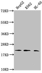 Western Blot Positive WB detected in: HepG2 whole cell lysate, K562 whole cell lysate, HL60 whole cell lysate All lanes: HIST1H1C antibody at 1:2000 Secondary Goat polyclonal to rabbit IgG at 1/40000 dilution Predicted band size: 22 kDa Observed b...