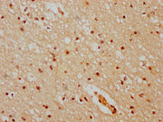 IHC image of CSB-PA010378OA51nhibHU diluted at 1:20 and staining in paraffin-embedded human brain tissue performed on a Leica BondTM system. After dewaxing and hydration, antigen retrieval was mediated by high pressure in a citrate buffer (pH 6.0)...