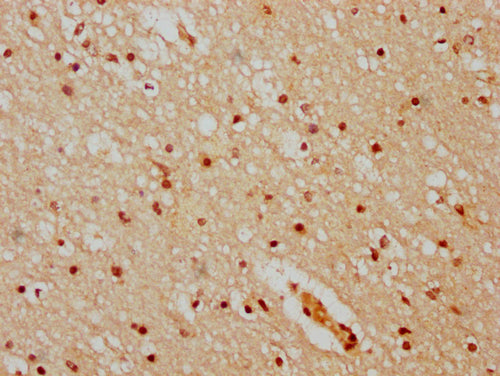 IHC image of CSB-PA010378OA51nhibHU diluted at 1:20 and staining in paraffin-embedded human brain tissue performed on a Leica BondTM system. After dewaxing and hydration, antigen retrieval was mediated by high pressure in a citrate buffer (pH 6.0)...
