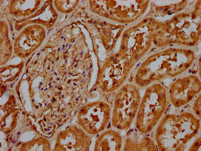 IHC image of CSB-PA010378OA62ncrHU diluted at 1:20 and staining in paraffin-embedded human kidney tissue performed on a Leica BondTM system. After dewaxing and hydration, antigen retrieval was mediated by high pressure in a citrate buffer (pH 6.0)...
