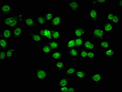 Immunofluorescence staining of Hela cells (treated with 30mM sodium butyrate for 4h) with CSB-PA010378OA74acHU at 1:7.5, counter-stained with DAPI. The cells were fixed in 4% formaldehyde, permeabilized using 0.2% Triton X-100 and blocked in 10% n...