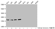 Western Blot Detected samples: Hela whole cell lysate, 293 whole cell lysate, A549 whole cell lysate, HepG2 whole cell lysate; Untreated (-) or treated (+) with 30mM sodium butyrate for 4h All lanes: HIST1H1C antibody at 2.6µg/ml Secondary Goat po...