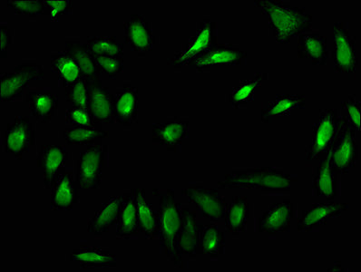 Immunofluorescence staining of Hela cells with CSB-PA010378OA84forHU at 1:5, counter-stained with DAPI. The cells were fixed in 4% formaldehyde, permeabilized using 0.2% Triton X-100 and blocked in 10% normal Goat Serum. The cells were then incuba...