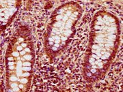 IHC image of CSB-PA010378OA89nforHU diluted at 1:10 and staining in paraffin-embedded human appendix tissue performed on a Leica BondTM system. After dewaxing and hydration, antigen retrieval was mediated by high pressure in a citrate buffer (pH 6...