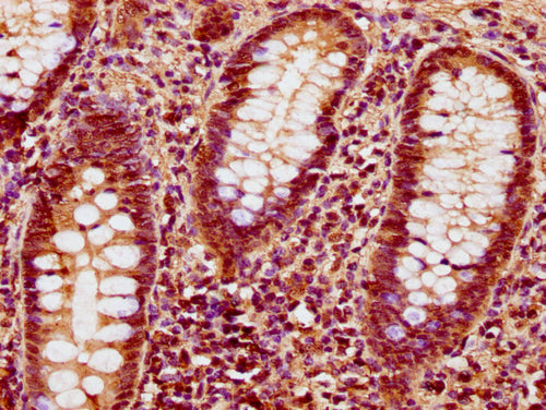 IHC image of CSB-PA010378OA89nforHU diluted at 1:10 and staining in paraffin-embedded human appendix tissue performed on a Leica BondTM system. After dewaxing and hydration, antigen retrieval was mediated by high pressure in a citrate buffer (pH 6...