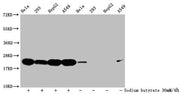 Western Blot Detected samples: Hela whole cell lysate, 293 whole cell lysate, HepG2 whole cell lysate, A549 whole cell lysate; Untreated (-) or treated (+) with 30mM sodium butyrate for 4h All lanes: HIST1H1C antibody at 1:500 Secondary Goat polyc...