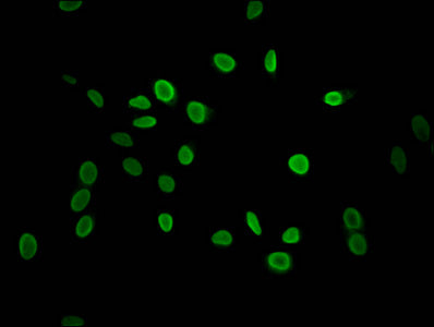 Immunofluorescent analysis of Hela cells using CSB-PA010378PA118me1HU at dilution of 1:100 and Alexa Fluor 488-congugated AffiniPure Goat Anti-Rabbit IgG(H+L)