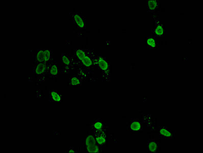 Immunofluorescent analysis of Hela cells using CSB-PA010378PA158ncrHU at dilution of 1:100 and Alexa Fluor 488-congugated AffiniPure Goat Anti-Rabbit IgG(H+L)