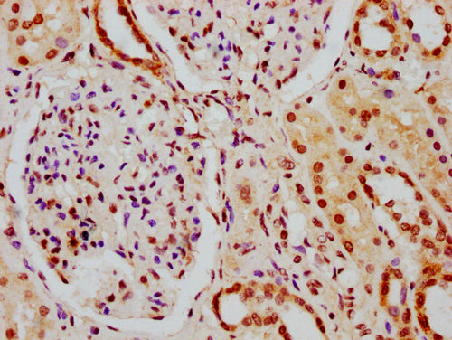 IHC image of CSB-PA010378PA164nphHU diluted at 1:10 and staining in paraffin-embedded human kidney tissue performed on a Leica BondTM system. After dewaxing and hydration, antigen retrieval was mediated by high pressure in a citrate buffer (pH 6.0...
