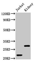 Western Blot Positive WB detected in: Jurkat whole cell lysate, Rat kidney tissue All lanes: HIST1H1C antibody at 1µg/ml Secondary Goat polyclonal to rabbit IgG at 1/50000 dilution Predicted band size: 22 kDa Observed band size: 22, 28 kDa