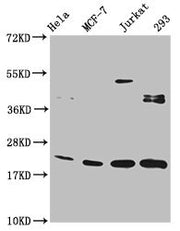 Western Blot Positive WB detected in: Hela whole cell lysate, MCF-7 whole cell lysate, Jurkat whole cell lysate, 293 whole cell lysate All lanes: HIST1H1C antibody at 1:100 Secondary Goat polyclonal to rabbit IgG at 1/50000 dilution Predicted band...