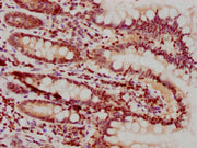 IHC image of CSB-PA010378PA25nhibHU diluted at 1:10 and staining in paraffin-embedded human small intestine tissue performed on a Leica BondTM system. After dewaxing and hydration, antigen retrieval was mediated by high pressure in a citrate buffe...