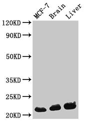Western Blot Positive WB detected in: MCF-7 whole cell lysate, Mouse brain tissue, Mouse liver tissue All lanes: HIST1H1C antibody at 0.3µg/ml Secondary Goat polyclonal to rabbit IgG at 1/50000 dilution Predicted band size: 22 kDa Observed band si...