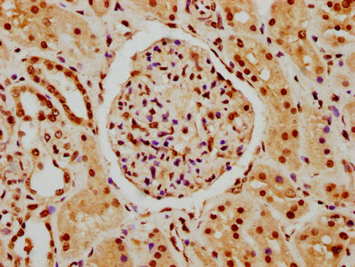 IHC image of CSB-PA010378PA45nhibHU diluted at 1:10 and staining in paraffin-embedded human kidney tissue performed on a Leica BondTM system. After dewaxing and hydration, antigen retrieval was mediated by high pressure in a citrate buffer (pH 6.0...