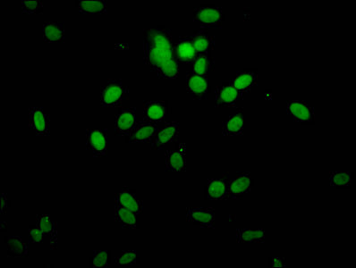 Immunofluorescent analysis of Hela cells (sodium butyrate, 30 mM, 4h) using CSB-PA010378PA51hibHU at dilution of 1:100 and Alexa Fluor 488-congugated AffiniPure Goat Anti-Rabbit IgG(H+L)