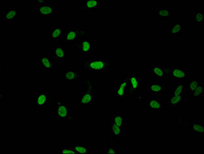 Immunofluorescent analysis of Hela cells using CSB-PA010378PA51nhibHU at dilution of 1:100 and Alexa Fluor 488-congugated AffiniPure Goat Anti-Rabbit IgG(H+L)