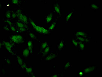 Immunofluorescent analysis of Hela cells using CSB-PA010378PA62nacHU at dilution of 1:100 and Alexa Fluor 488-congugated AffiniPure Goat Anti-Rabbit IgG(H+L)
