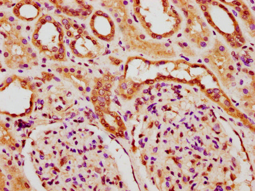 IHC image of CSB-PA010378PA84nforHU diluted at 1:20 and staining in paraffin-embedded human kidney tissue performed on a Leica BondTM system. After dewaxing and hydration, antigen retrieval was mediated by high pressure in a citrate buffer (pH 6.0...