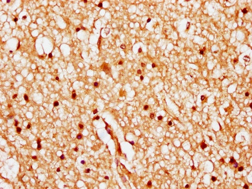 IHC image of CSB-PA010378PA84nhibHU diluted at 1:20 and staining in paraffin-embedded human brain tissue performed on a Leica BondTM system. After dewaxing and hydration, antigen retrieval was mediated by high pressure in a citrate buffer (pH 6.0)...