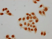 Immunocytochemistry analysis of CSB-PA010378PA89acHU diluted at 1:15 and staining in Hela cells(treated with 30mM sodium butyrate for 4h) performed on a Leica BondTM system. The cells were fixed in 4% formaldehyde, permeabilized using 0.2% Triton...