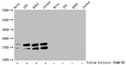 Western Blot Detected samples: Hela whole cell lysate, 293 whole cell lysate, K562 whole cell lysate, Jurkat whole cell lysate; Untreated (-) or treated (+) with 30mM sodium butyrate for 4h All lanes: HIST1H1C antibody at 1:2000 Secondary Goat pol...