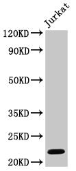 Western Blot Positive WB detected in: Jurkat whole cell lysate All lanes: HIST1H1C antibody at 1µg/ml Secondary Goat polyclonal to rabbit IgG at 1/50000 dilution Predicted band size: 22 kDa Observed band size: 22 kDa