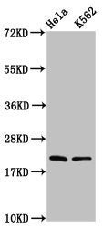 Western Blot Positive WB detected in: Hela whole cell lysate, K562 whole cell lysate All lanes: HIST1H1D antibody at 1.25µg/ml Secondary Goat polyclonal to rabbit IgG at 1/50000 dilution Predicted band size: 23 kDa Observed band size: 23 kDa