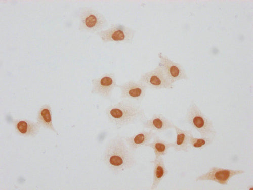 Immunocytochemistry analysis of CSB-PA010379OA140forHU diluted at 1:20 and staining in Hela cells(treated with 30mM sodium butyrate for 4h) performed on a Leica BondTM system. The cells were fixed in 4% formaldehyde, permeabilized using 0.2% Trito...