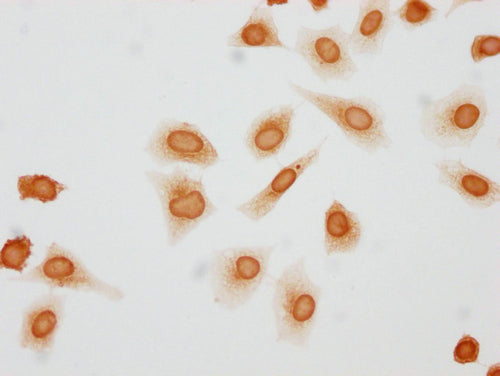 Immunocytochemistry analysis of CSB-PA010379OA146phHU diluted at 1:10 and staining in Hela cells(treated with 50nM Calyculin A for 30min) performed on a Leica BondTM system. The cells were fixed in 4% formaldehyde, permeabilized using 0.2% Triton...