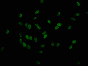Immunofluorescence staining of Hela cells with CSB-PA010379OA179phHU at 1:25, counter-stained with DAPI. The cells were fixed in 4% formaldehyde, permeabilized using 0.2% Triton X-100 and blocked in 10% normal Goat Serum. The cells were then incub...