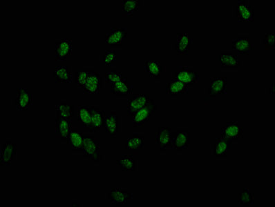 Immunofluorescence staining of Hela cells with CSB-PA010379OA179phHU at 1:25, counter-stained with DAPI. The cells were fixed in 4% formaldehyde, permeabilized using 0.2% Triton X-100 and blocked in 10% normal Goat Serum. The cells were then incub...