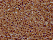 IHC image of CSB-PA010379OA34nbhbHU diluted at 1:20 and staining in paraffin-embedded human adrenal gland tissue performed on a Leica BondTM system. After dewaxing and hydration, antigen retrieval was mediated by high pressure in a citrate buffer...