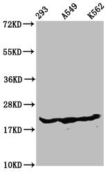 Western Blot Positive WB detected in: 293 whole cell lysate, A549 whole cell lysate, K562 whole cell lysate (all treated with 30mM sodium butyrate for 4h) All lanes: HIST1H1D antibody at 1.3µg/ml Secondary Goat polyclonal to rabbit IgG at 1/50000...